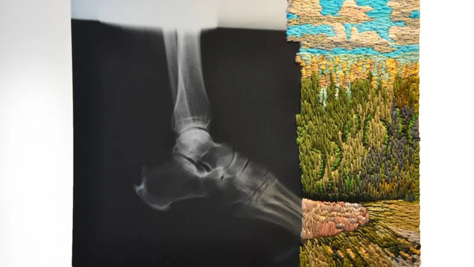 Paging Columbus: Fractures and Scars